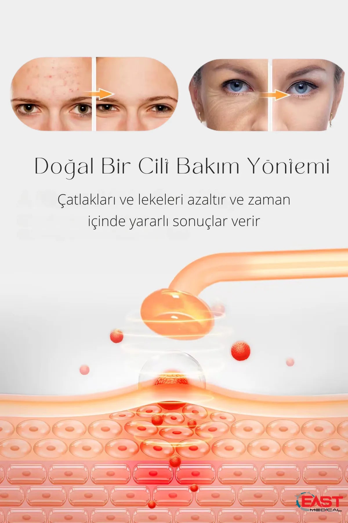 Lucilema Yüksek Frekans Cilt Temizleyici ve Bakım Cihazı 4 başlıklı